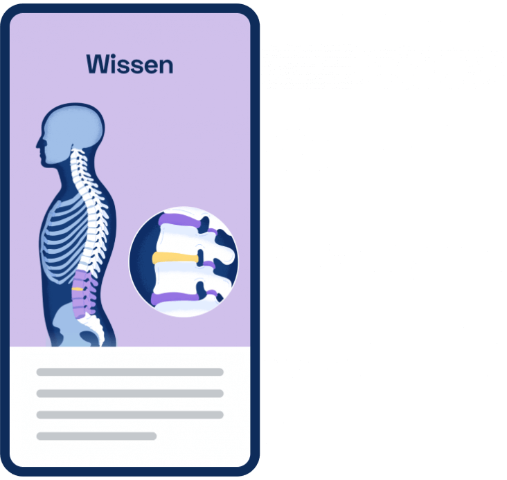 Darstellung eines Smartphones auf die Kaia Rückenschmerzen App geöffnet ist und die Illustration eines Rückens zu sehen ist.